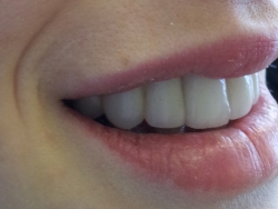 after