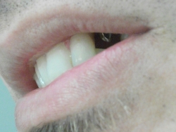 before