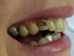 before